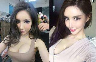 网红假胸打爆,揭秘网络暴力与审美误区