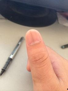 指头条,聚焦热点，解码时代脉搏